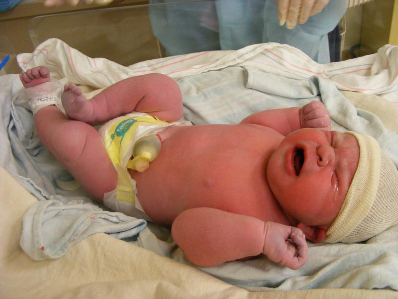 Baby's first diaper