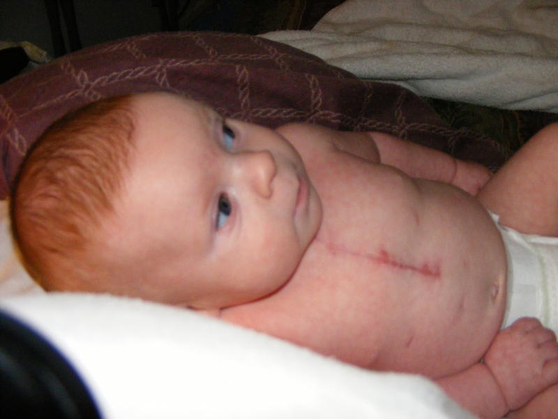 Nice scar