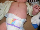 Belly Button!